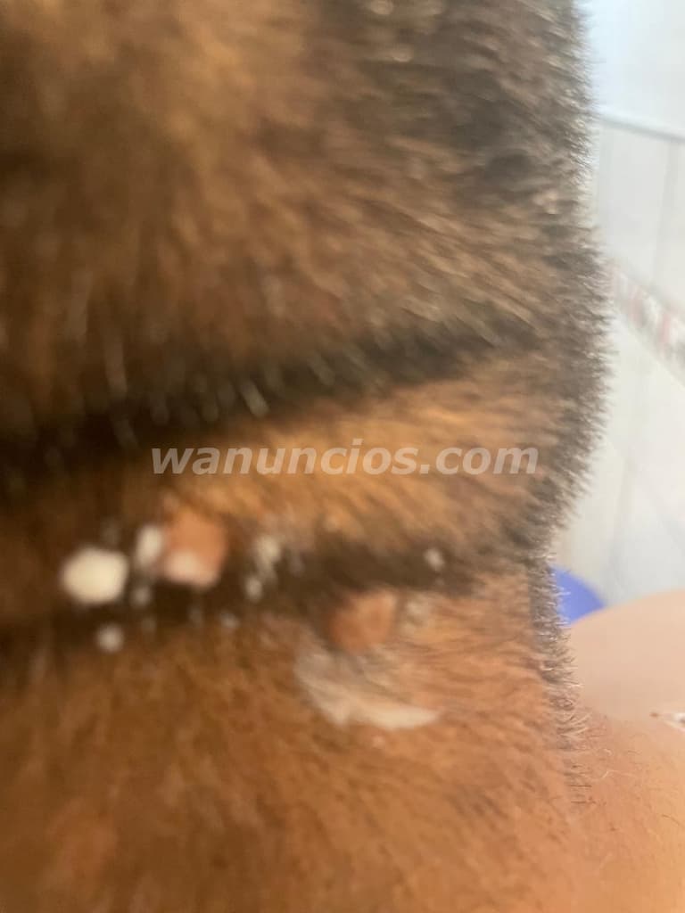 3.500 Pesos - tecnica laser y terapista en republica dominicana (santo domingo) 4